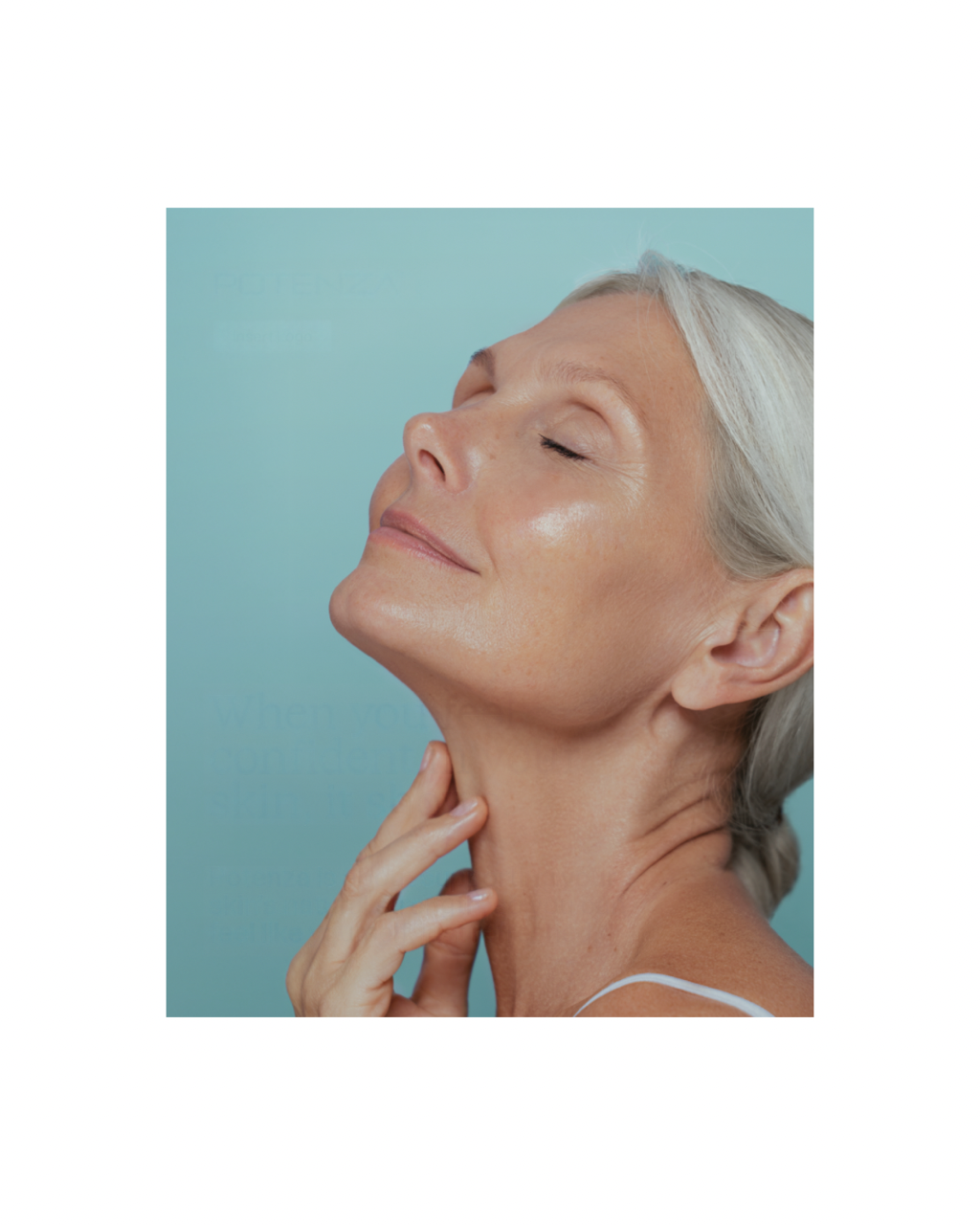 Potenza RF microneedling skin rejuvenation treatment